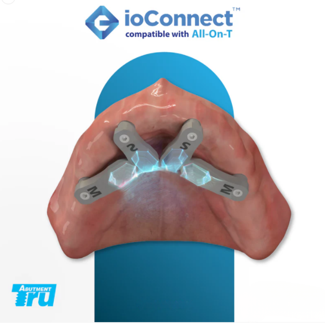 ioConnect All-on-T